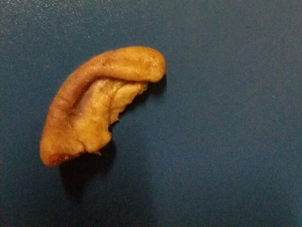 Parte de uma orelha arrancada