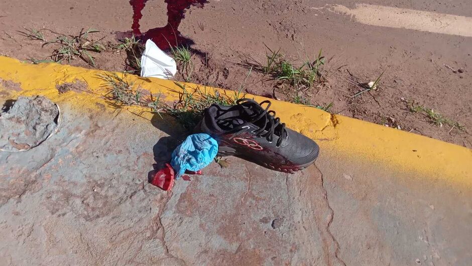 Ciclista teve a cabe&ccedil;a esmagada pelo &ocirc;nibus