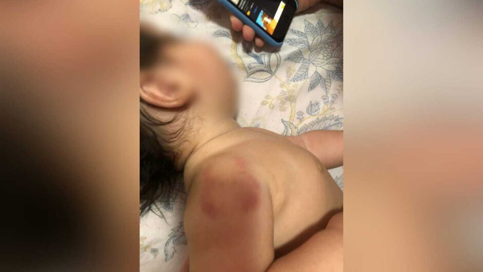 A criança tem 10 meses