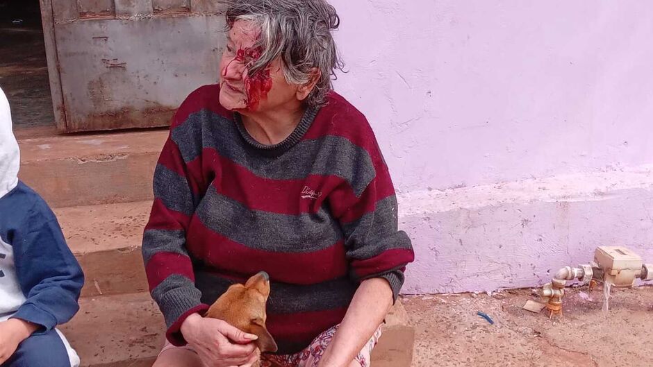 Idosa foi agredida pelo neto após chamar atenção dele