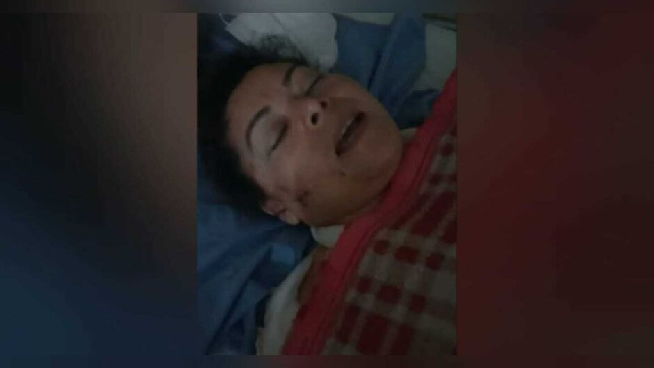 Audineth após a agressão