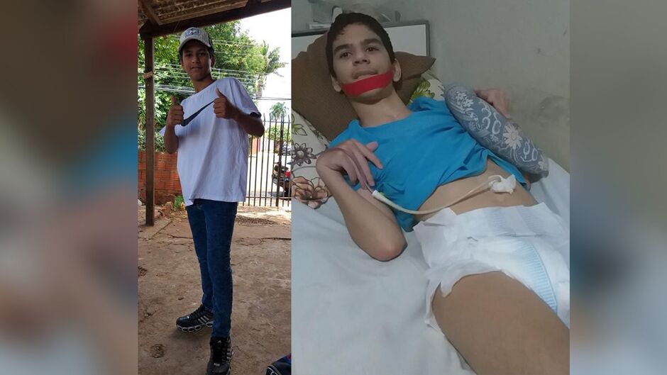Rafael antes e depois do acidente