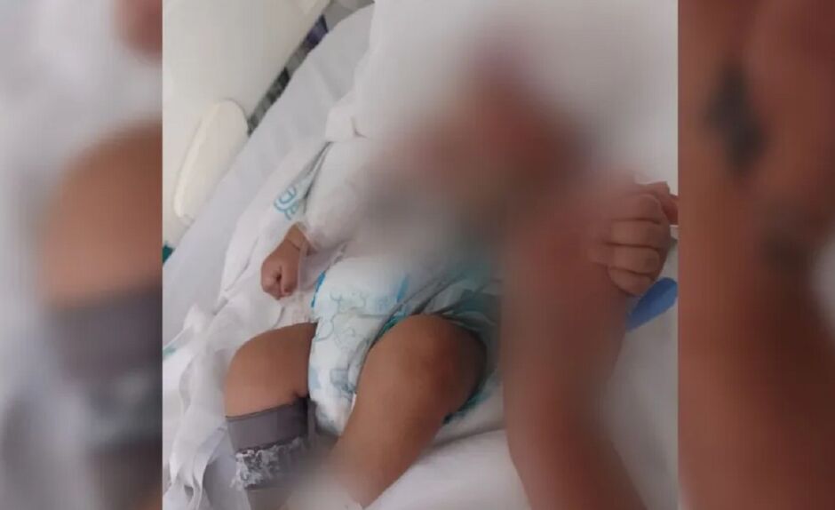 Bebê morreu com golpe na cabeça 
