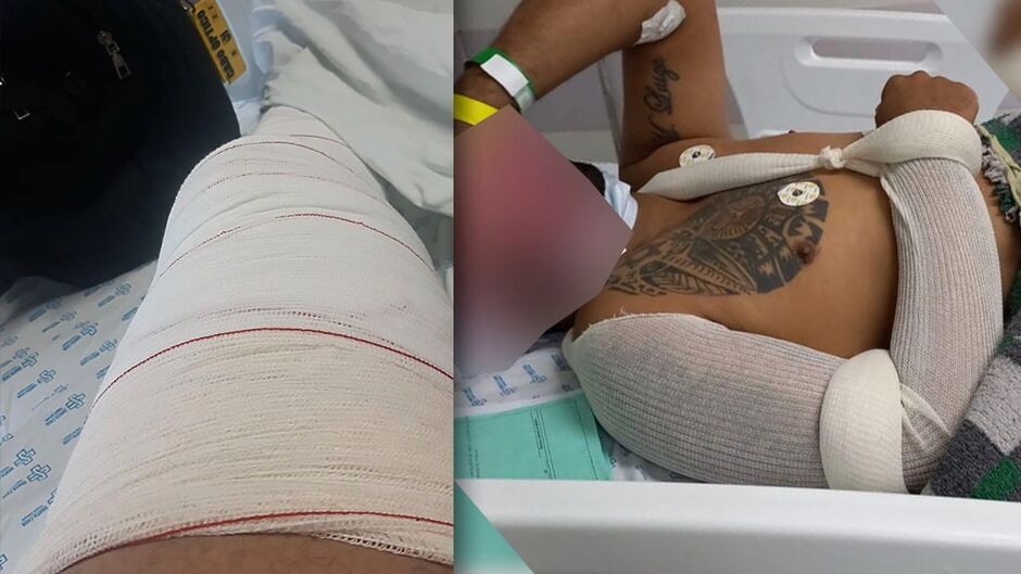 Jovem sofreu fratura no joelho e passou por cirurgia