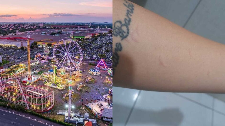 Stefanny alega que a funcionária a teria pegado pelo braço e a arranhado com as unhas