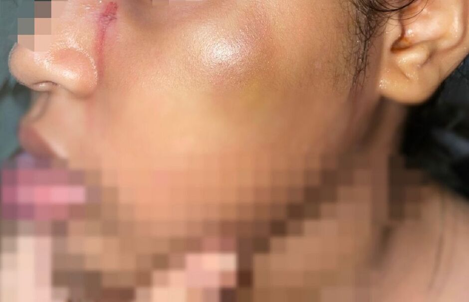 Criança apanhava até perder a fome 