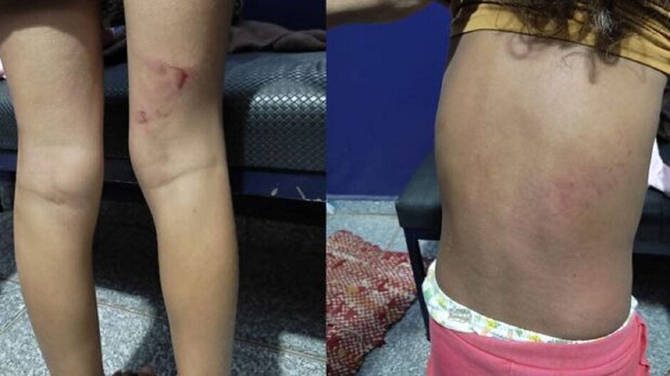 Crianças espancadas em Chapadão do Sul
