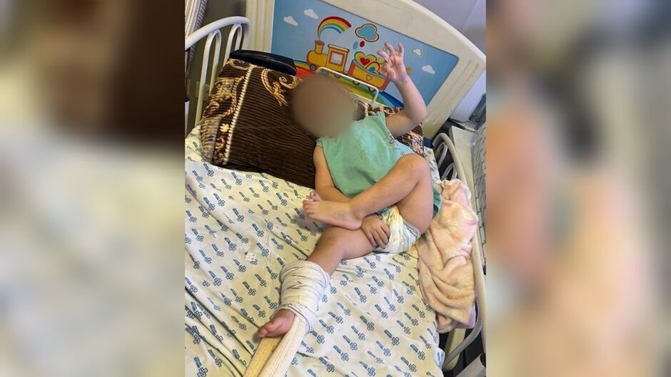Criança está no aguardo da cirurgia na Santa Casa 