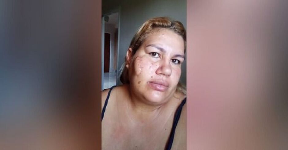 Iara faz rifa para pagar cirurgia que custa mais de R$ 5 mil 