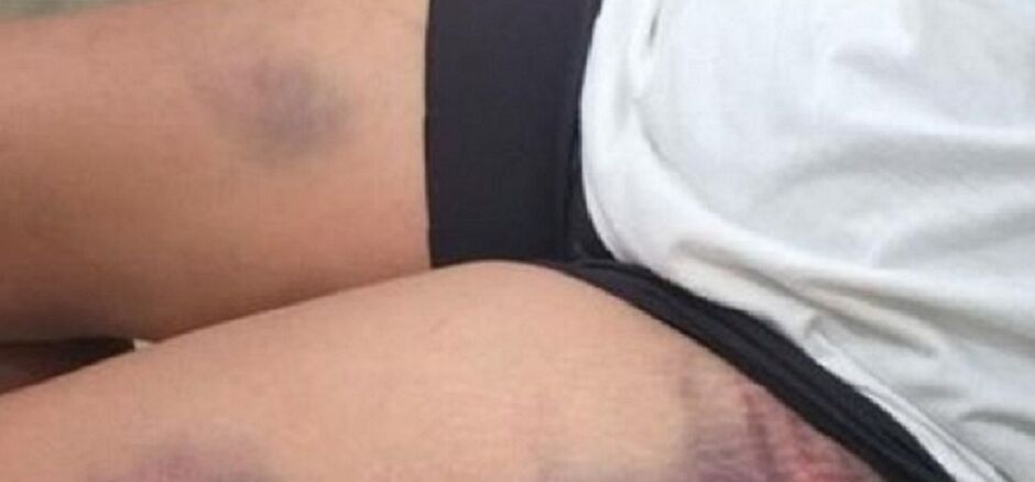 Mulher foi afogada duas vezes - ilustrativa - TS 