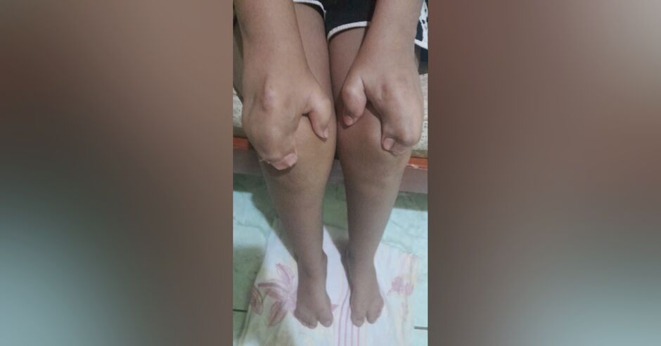 Menino tem 13 anos e precisa fazer cirurgia 