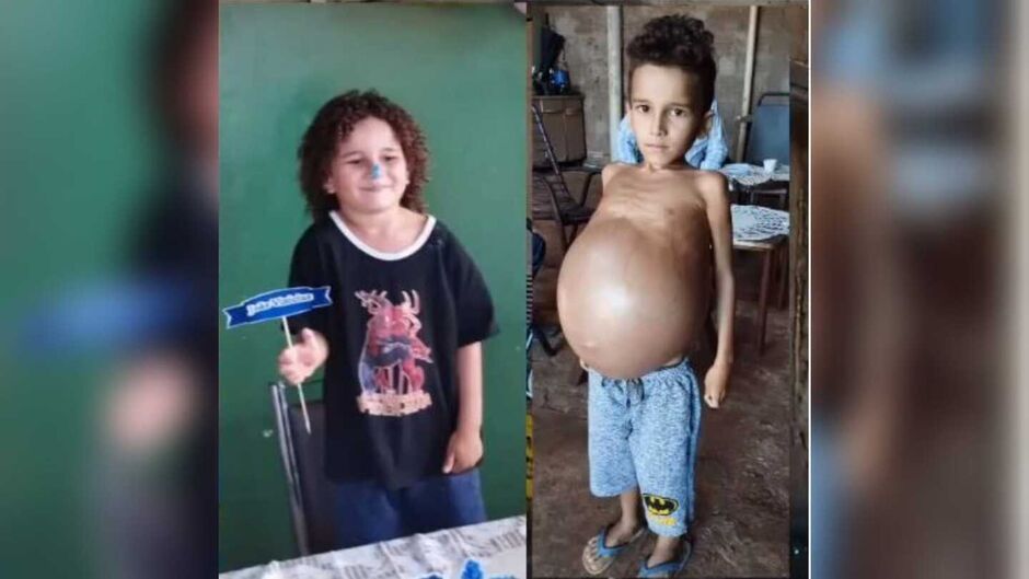 Antes e depois de João descobrir a doença