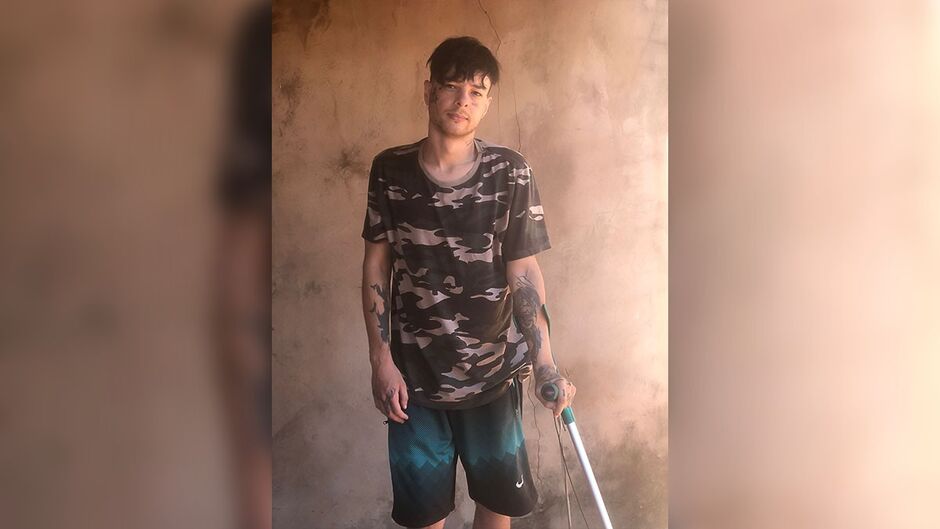 Jovem faz tratamento para esclerose múltipla em Campo Grande