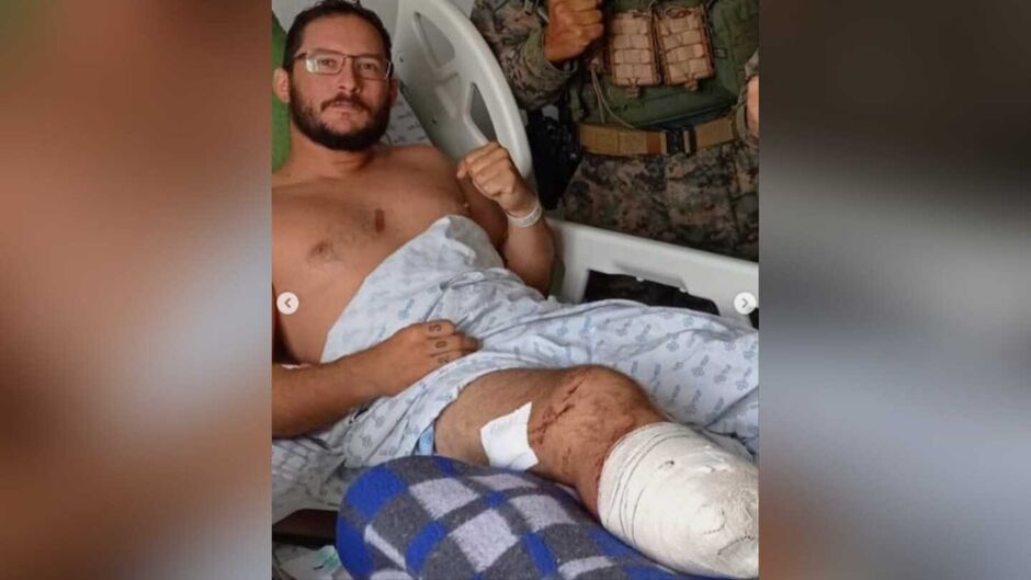 Ele sofreu um grave ferimento no pé direito que precisou ser amputado
