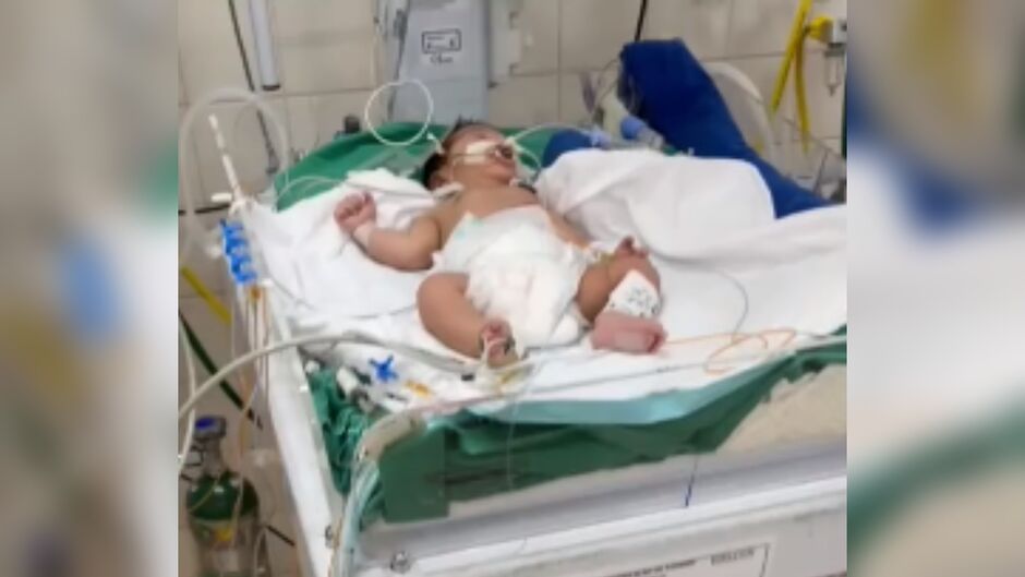 Sem UTI neonatal, a bebê foi colocada em uma sala de cirurgia, que foi improvisada para receber os recém-nascidos em estado grave