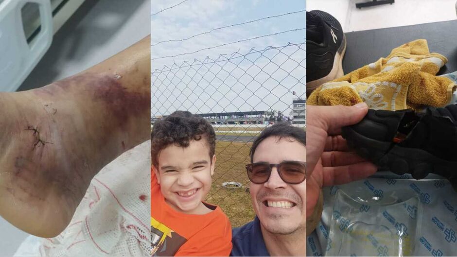 Marcas da cirurgia feita pelo Ricardo; pai e filho registraram momento antes do acidente; tênis rasgou após ser atingido pela peça