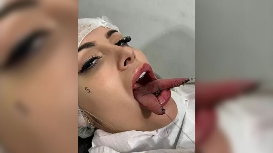 Andressa Urach faz cirurgia para ter 'língua de cobra' e dar mais prazer aos clientes