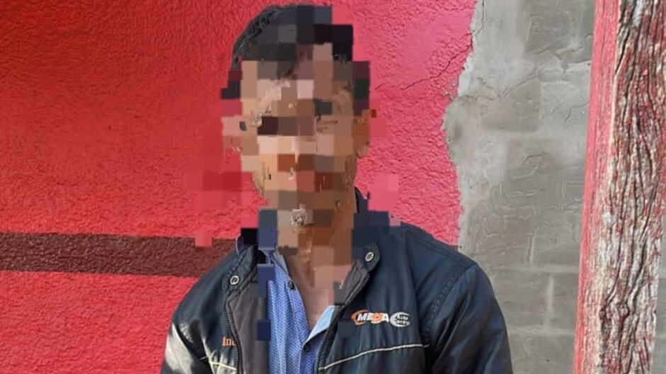 Autor foi detido e encaminhado à Primeira Delegacia de Polícia Civil