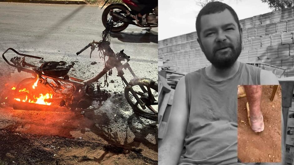 Embora não tenha se machucado, a motocicleta foi completamente destruída pelo fogo