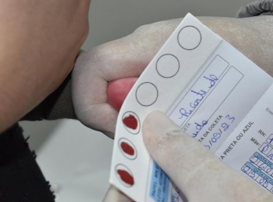 Entidade comprou kits para testes  