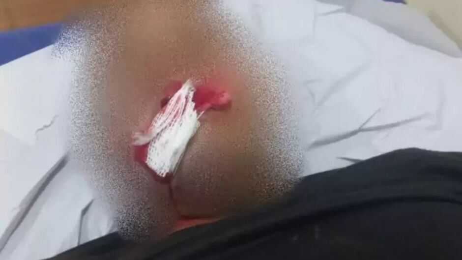 Devido à gravidade dos ferimentos, ele está internado no Hospital Auxiliadora