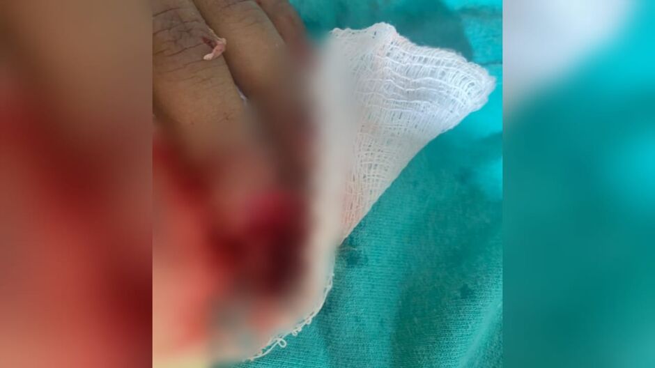 O acidente aconteceu em uma praça do bairro