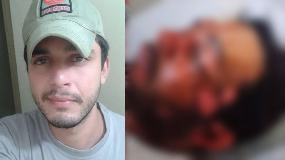 Homem atacado com água fervente continua internado e pode perder a visão do olho direito 