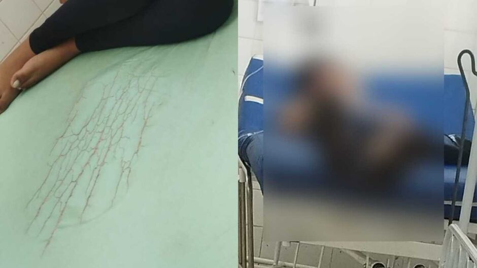 'Balde com vômito e maca suja', relata mãe de paciente sobre situação em Upa no Aero Rancho
