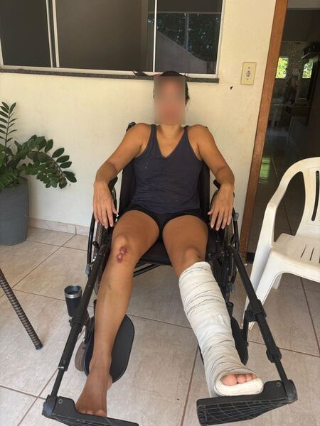 Ela quebrou o nariz, trincou o Cóccix, o metatarso - osso do pé -, com necessidade de se locomover em cadeira de rodas