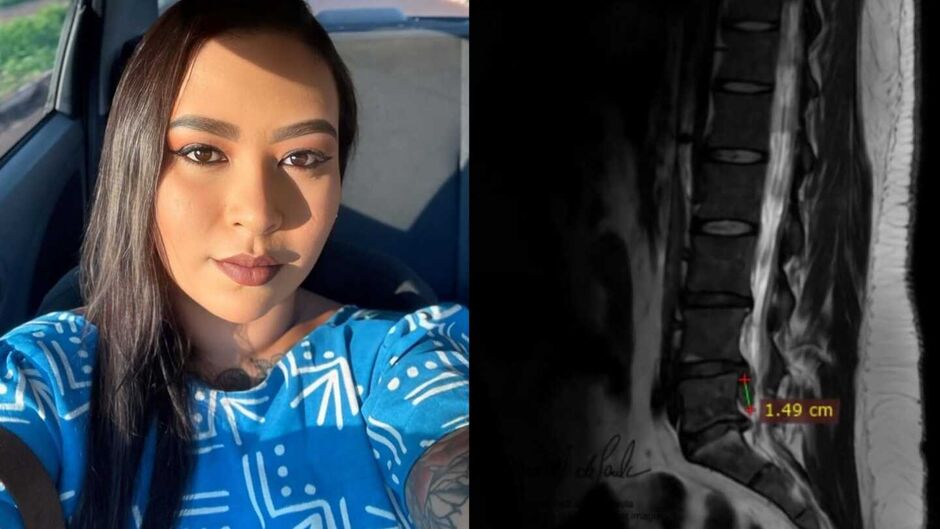 Ana precisa arrecadar fundos para a cirurgia