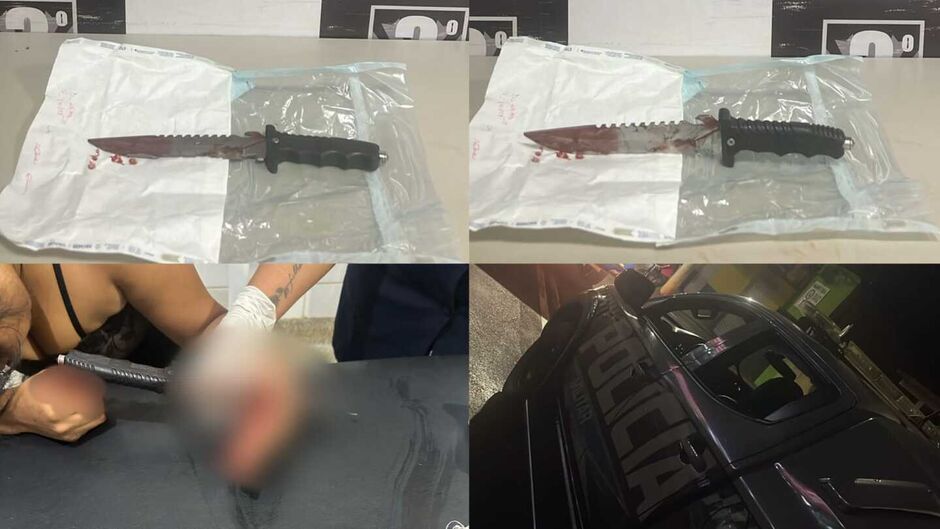 Mulher chegou ao hospital com a faca ainda cravada na mão