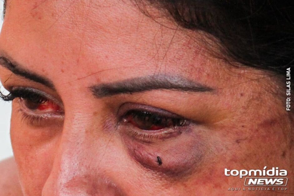 Imagem de uma vítima de violência doméstica e tentativa de feminicídio em Campo Grande