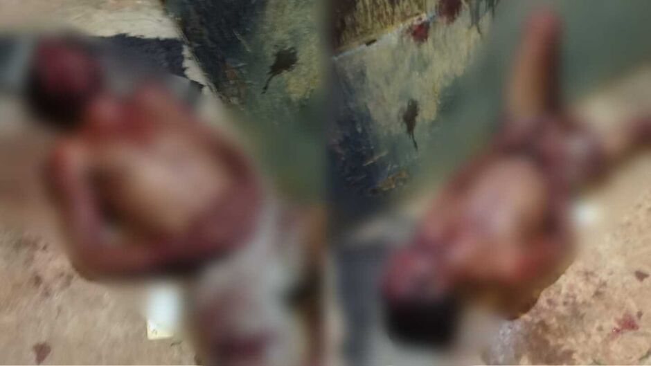 Morador ficou com v&aacute;rios ferimentos pelo corpo