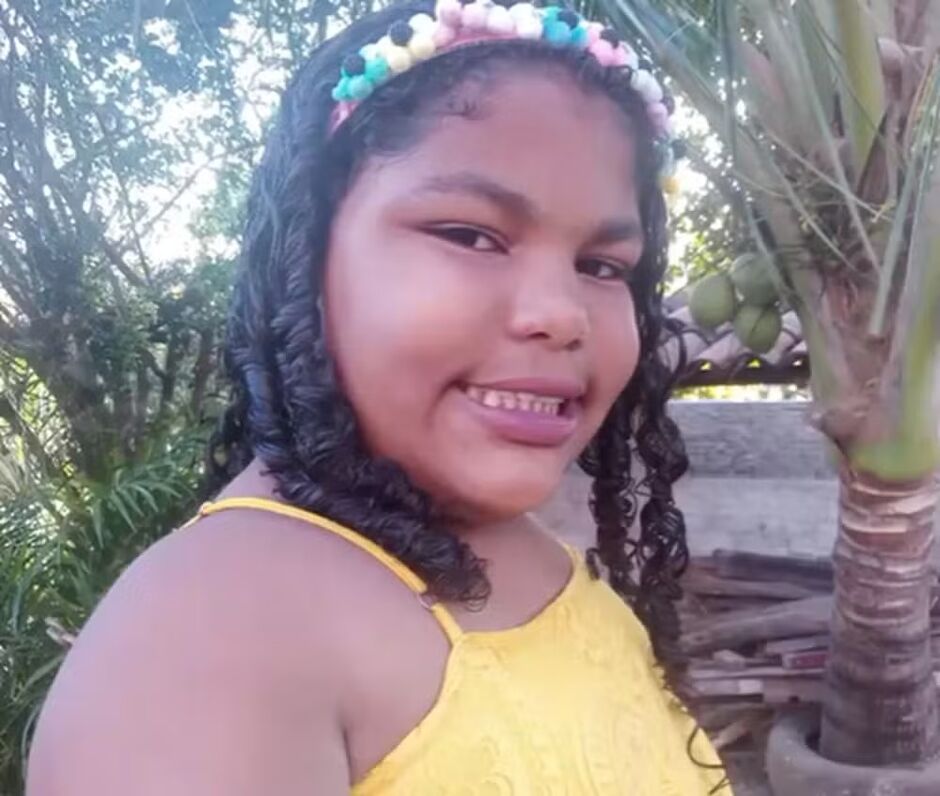 Brenda Sophia Melo de Santana estava com a língua coberta por um material esbranquiçado