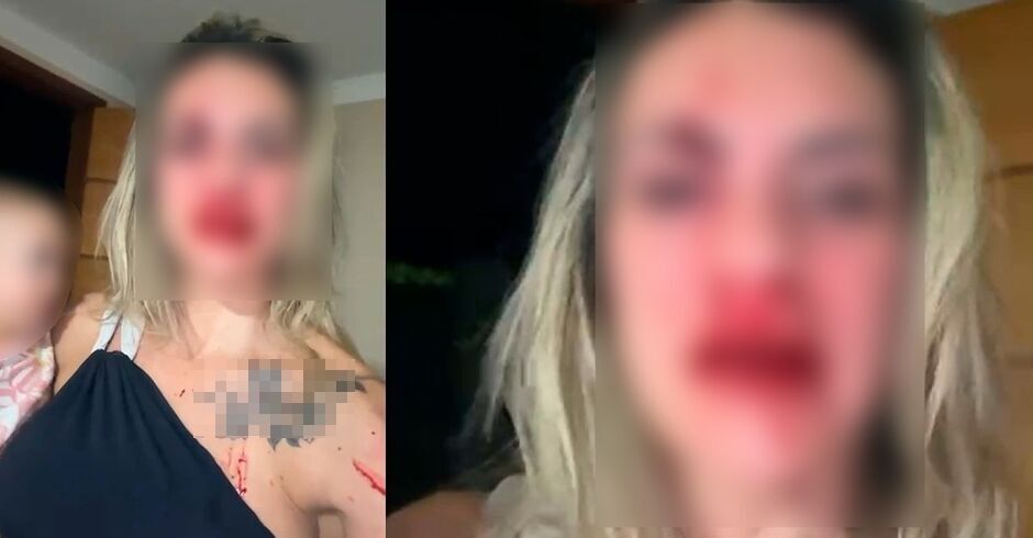 Vítima teve nariz fraturado pelo acusado