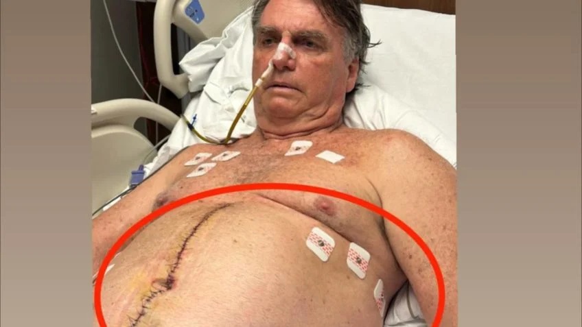 Médico sugere acompanhamento constante do pós-cirurgia