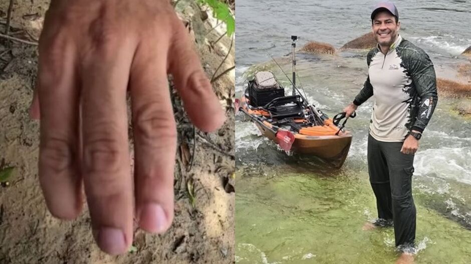 Pescador mostra dedo decepado por onça 