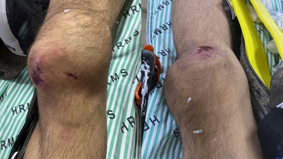 Inchaço nos dois joelhos do trabalhador