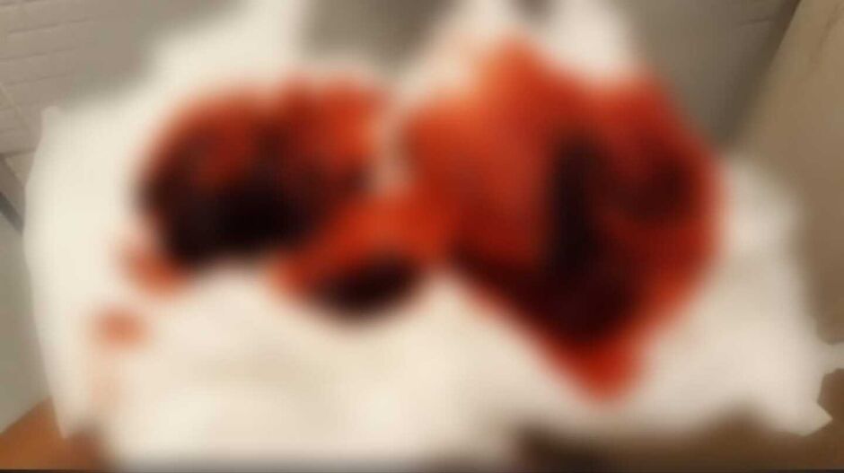 Vítima teve sangramento na ferida