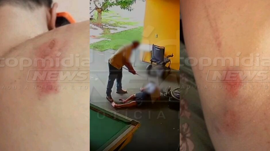 Marcas no corpo da vítima após ser espancado