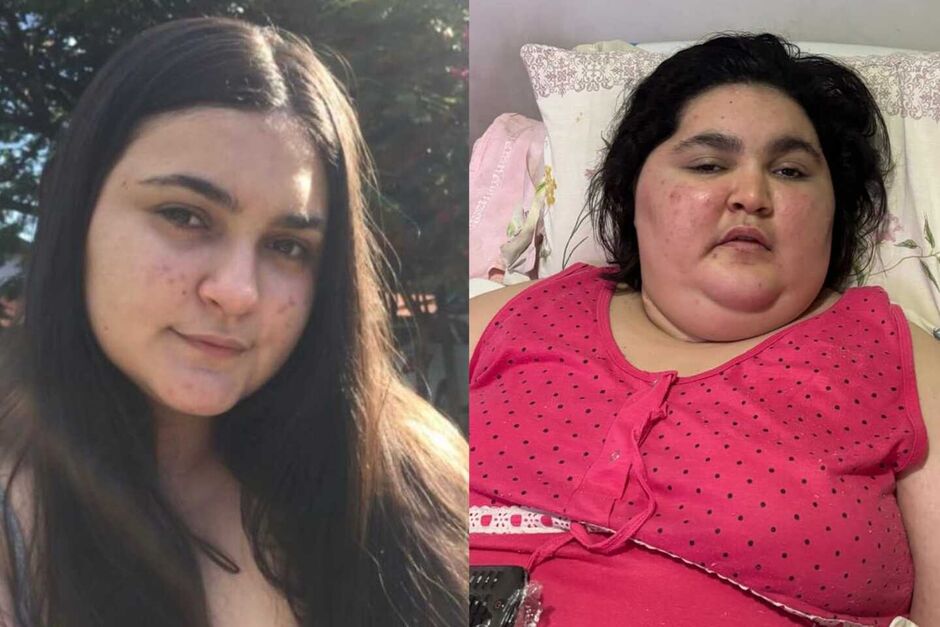Jovem antes e depois das doenças