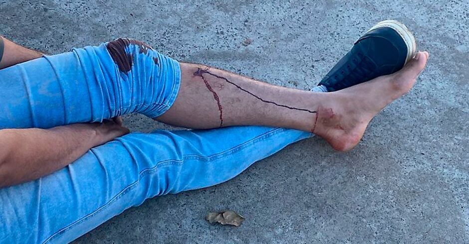 Ele ficou no local aguardando o socorro, sentado no chão