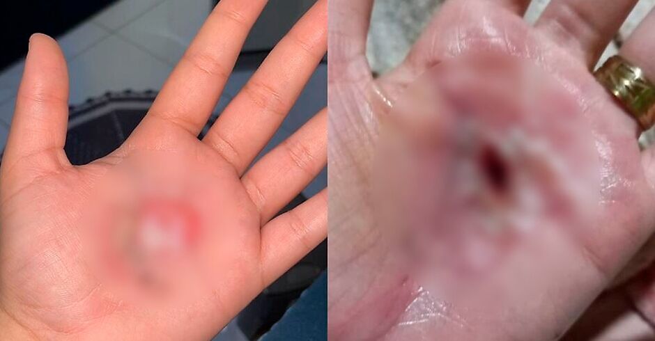 Mão das vítimas do pai de santo