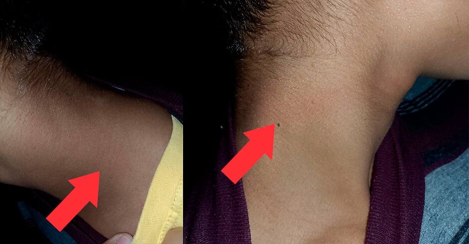 O menino ficou com marcas no pescoço após ser amarrado por uma corda