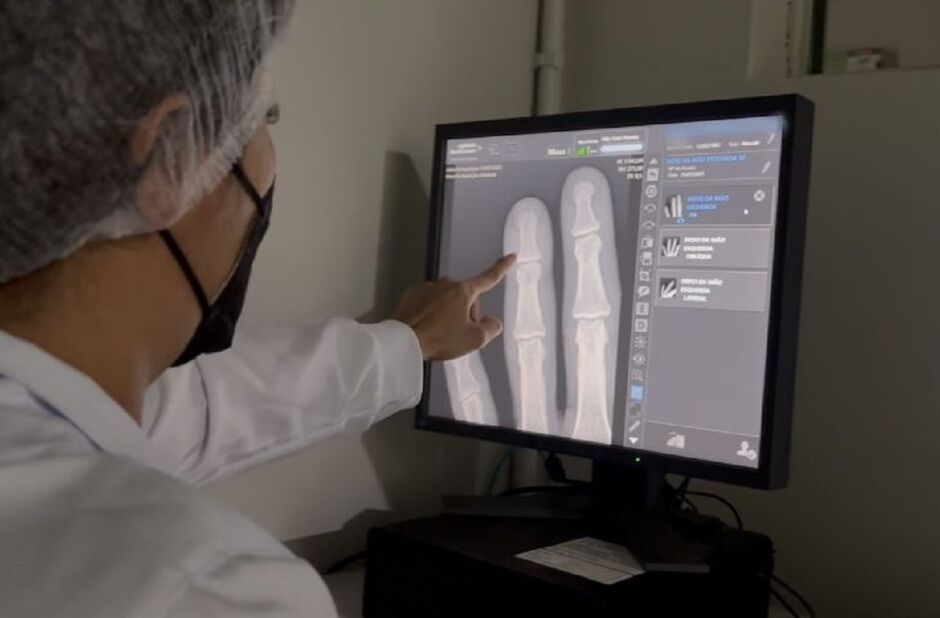 Aparelhos entregues são de alta resolução 