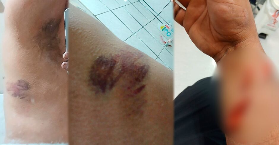 Homem mostra marcas das agressões sofridas pela ex-esposa durante brigas do casal