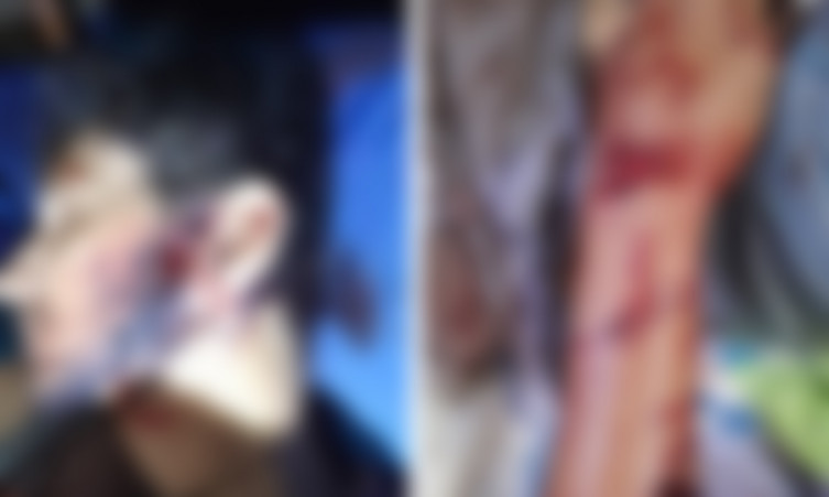 A vítima foi socorrida em estado grave