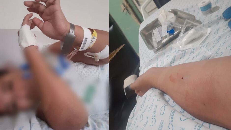 Amanda quase morreu após ter uma infecção grave