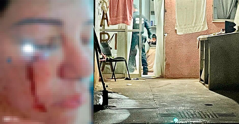 Mulher agredida um dia depois de terminar com agressor