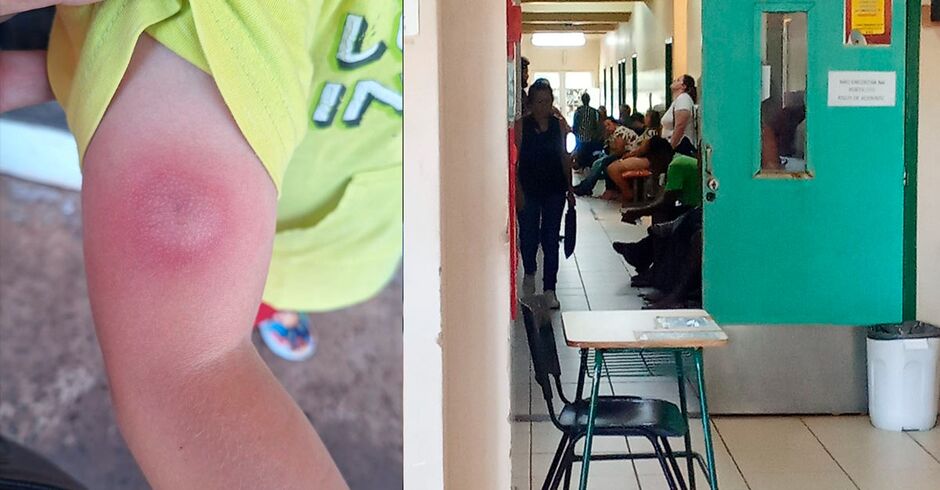 Mãe procura Upa após seu filho ser picado por aranha e tem que aguardar 3 horas